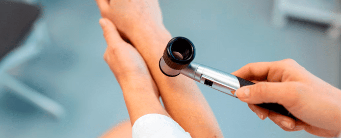 Learn how to detect melanoma by regularly checking your skin, recognising the ABCDEs of melanoma, and consulting a dermatologist for any concerns