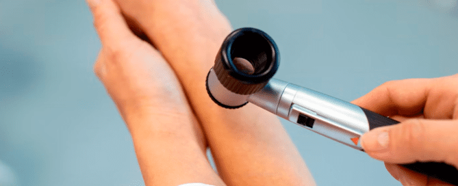 Learn how to detect melanoma by regularly checking your skin, recognising the ABCDEs of melanoma, and consulting a dermatologist for any concerns